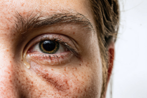 Up close image of a man with a single tear on his face from watery eyes